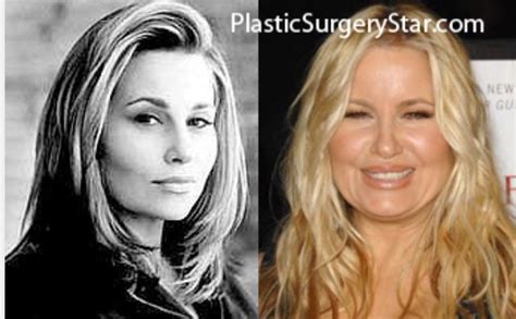 Jennifer Coolidge Before Plastic Surgery: The。